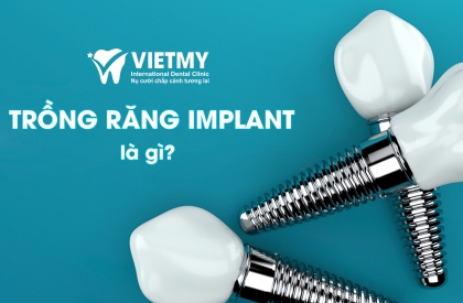 TRỒNG RĂNG IMPLANT - PHƯƠNG PHÁP PHỤC HÌNH RĂNG HIỆU QUẢ VÀ CẢI THIỆN SỨC KHỎE